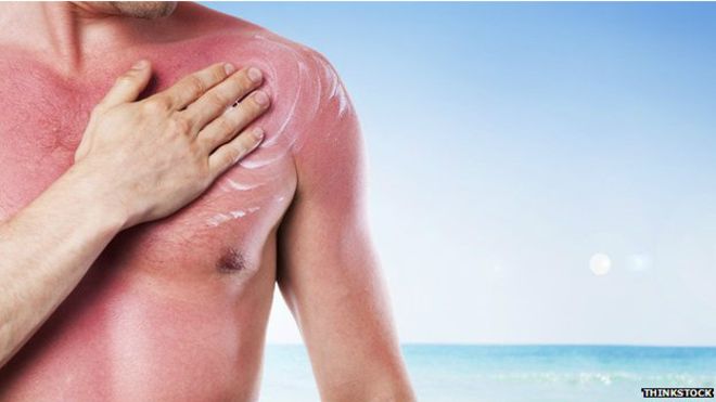 Campa&ntilde;a gratuita de despistaje contra c&aacute;ncer de piel en playas de Lima