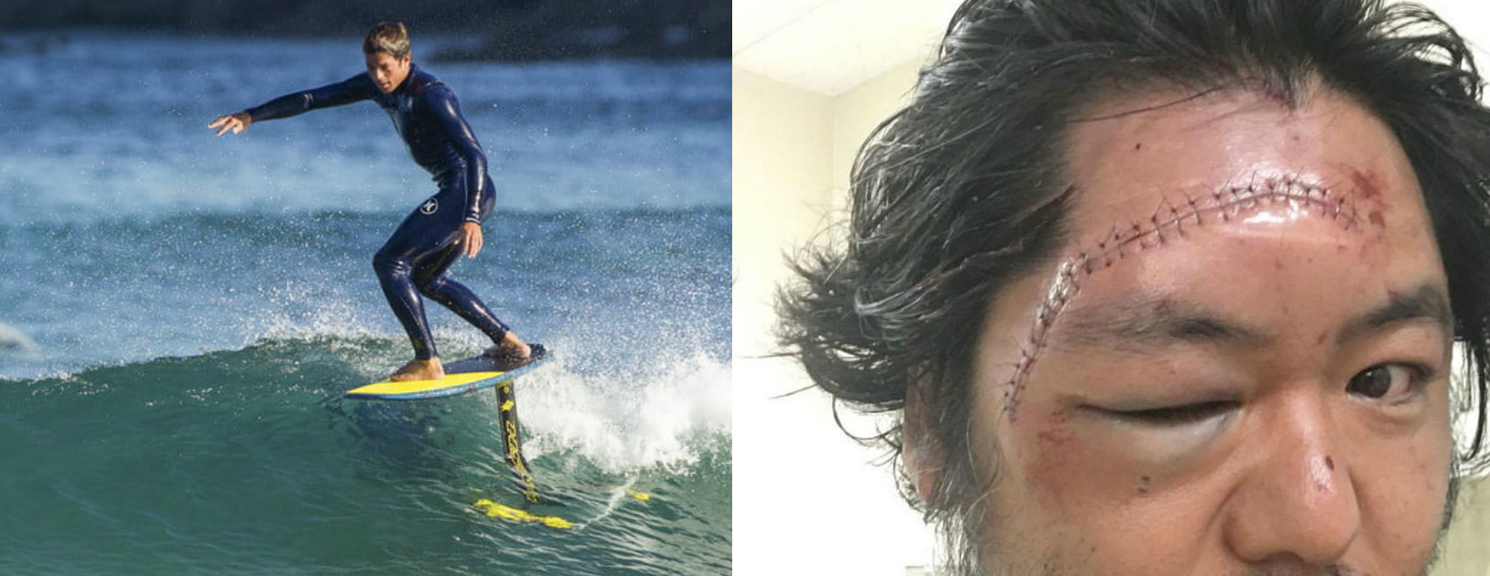 Prohiben el hydrofoil en playas de Anglet  