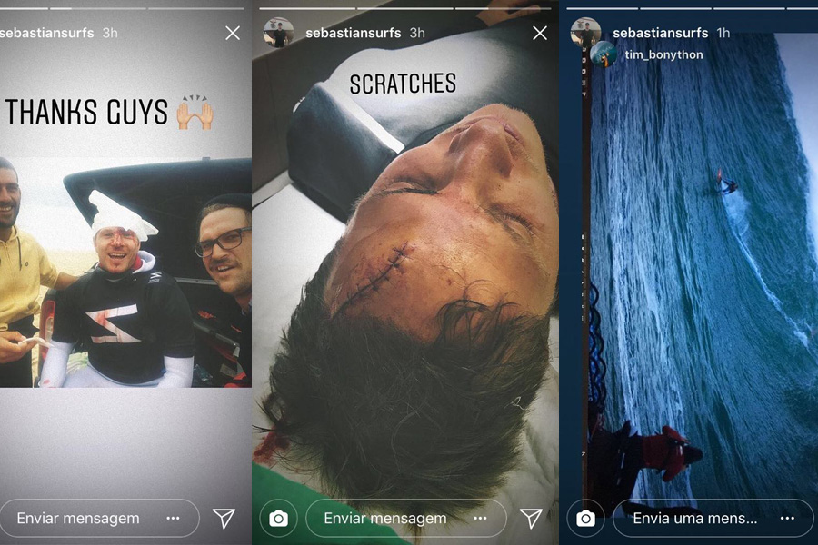 As&iacute; qued&oacute; la cabeza de Sebastian Steudtner este domigo en Nazar&eacute;