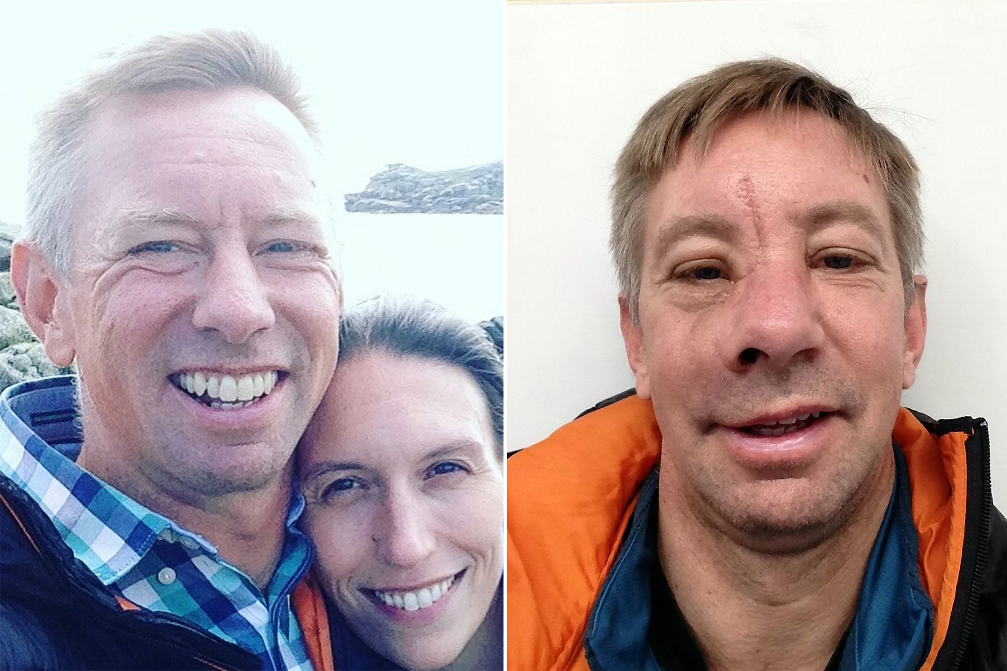 Recontruyen rostro de surfista tras sufrir terror&iacute;fico wipeout