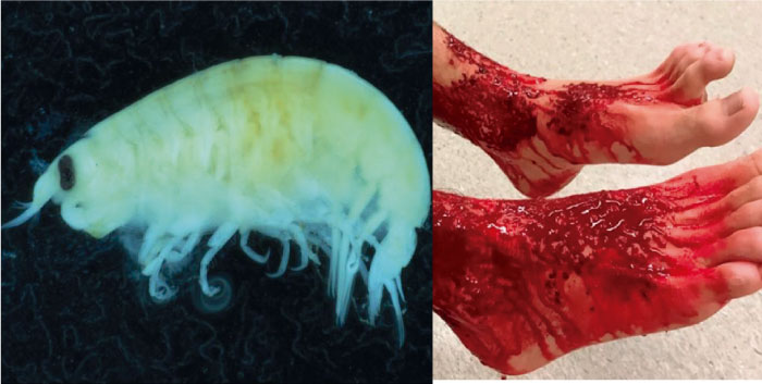 Se resuelve el misterio de criaturas marinas que se alimentaron de las piernas de joven en Australia 
