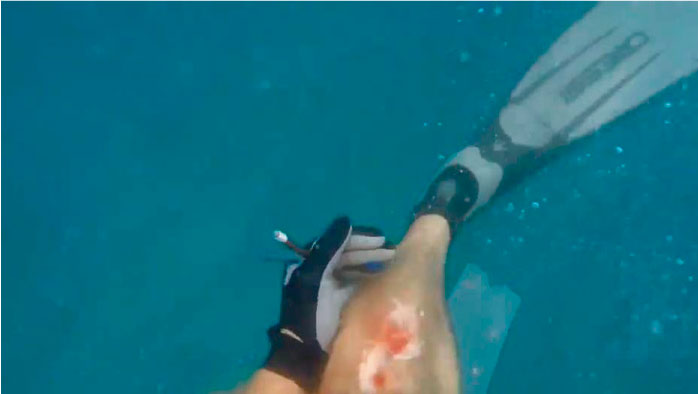 Pescador graba momento preciso cuando tibur&oacute;n le devora pedazo de pierna 