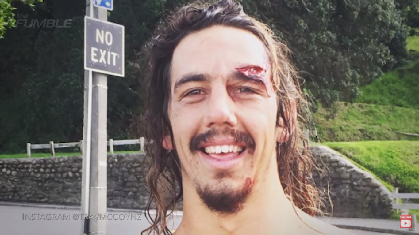 Surfista se entera que tiene tumor cerebral gracias a un wipeout