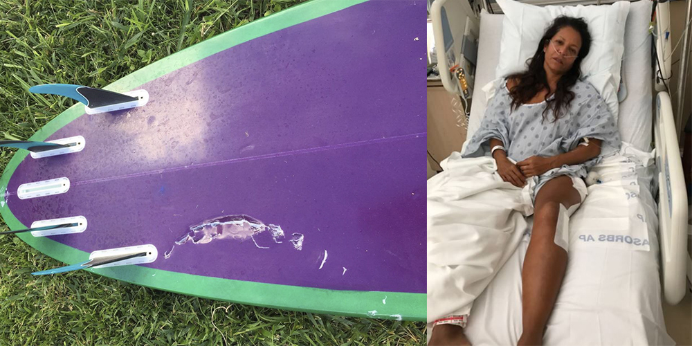 Hawaii: Surfista brasilera se salva de morir tras ataque de tibur&oacute;n tigre