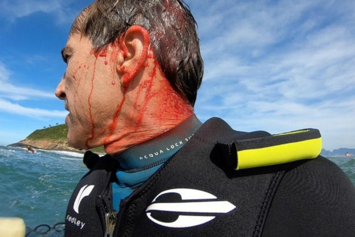Carlos Burle pierde el conocimiento y se corta la cabeza surfeando en R&iacute;o