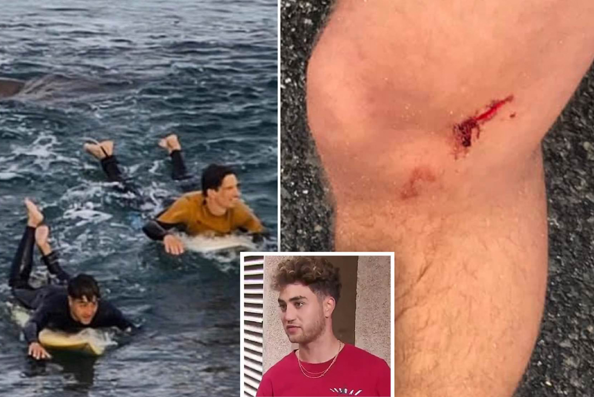 Surfista sobrevive a golpes al ataque de un tibur&oacute;n