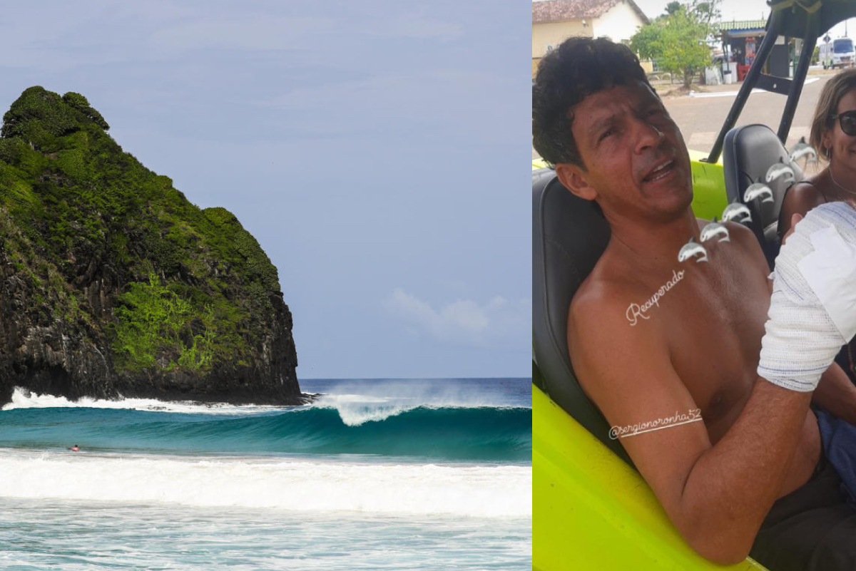 Ex surfista profesional es atacado por tibur&oacute;n en Fernando de Noronha
