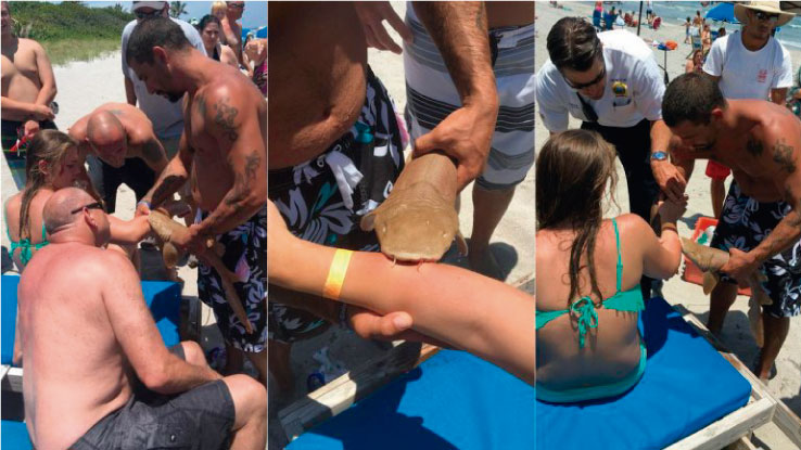 Joven es mordida en el brazo por tibur&oacute;n y este no la suelta hasta llegar al hospital 

